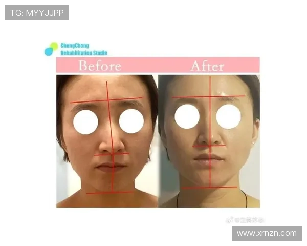 “整容日记”:面部变迁中的自我探索与蜕变之路 “整容日记”:面部变迁中的自我探索与蜕变之路